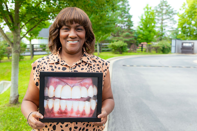 iDENTity Dental Studio Full Mouth Dental Implants Lexington, KY